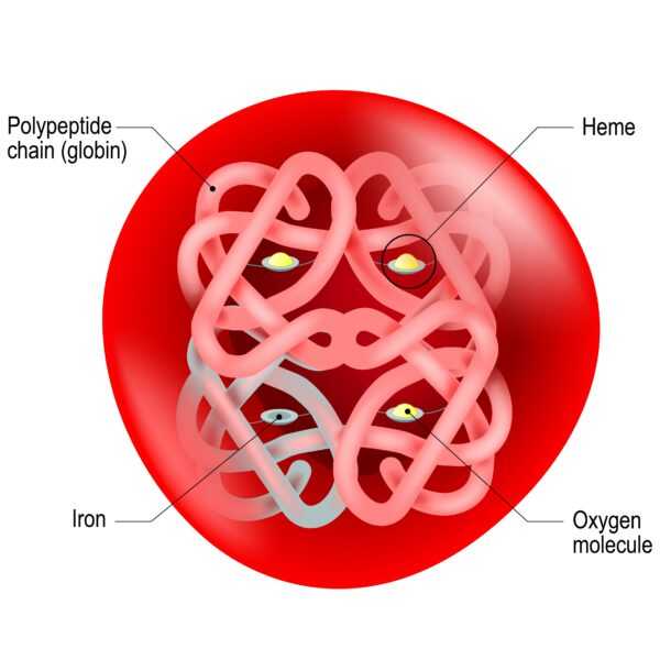 A diagram showing the structure of a red blood cell focusing on Iron Deficiency.
